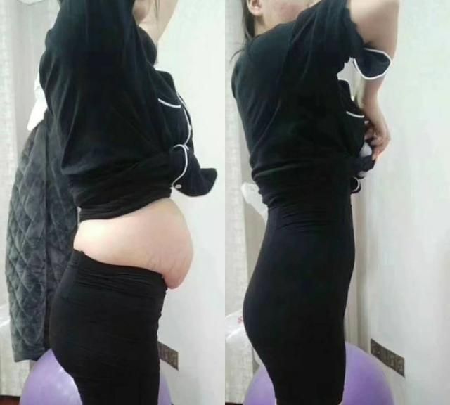 剖腹产3次一般多少周可以剖,剖腹产一般选在多少周图7