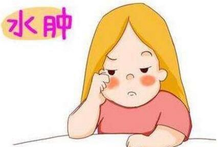 怀孕后期脚水肿吃什么好(怀孕后期水肿原因)图1